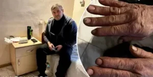 Побиття сантехніка Олексієм Михайличенком: депутати відвідали постраждалого в лікарні