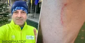 Нардепа Мазураша покусала собака в центрі Києва